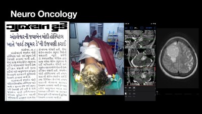 Smt. Jayaben Mody Hospital Nuerology