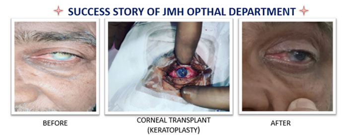 ophthalmology-2