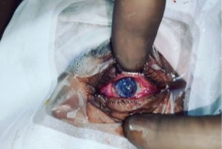 opthalmology